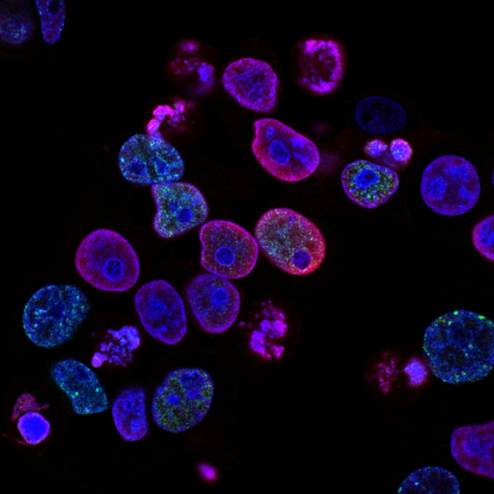 Fluorescent microscopy image of stained cells in blue and magenta